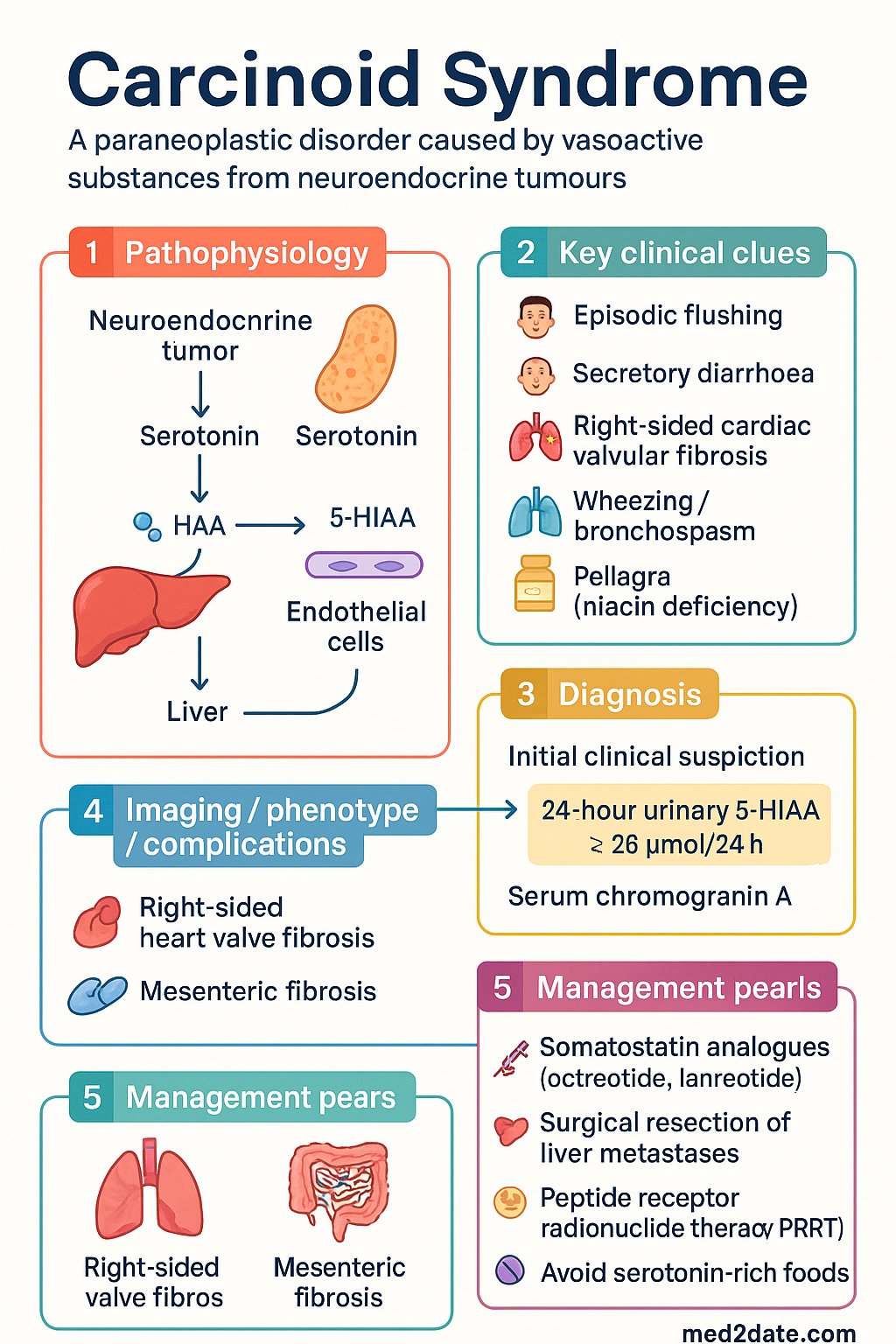 Carcinoid Syndrome clinical infographic — pathophysiology, clinical clues, diagnosis, imaging, and management