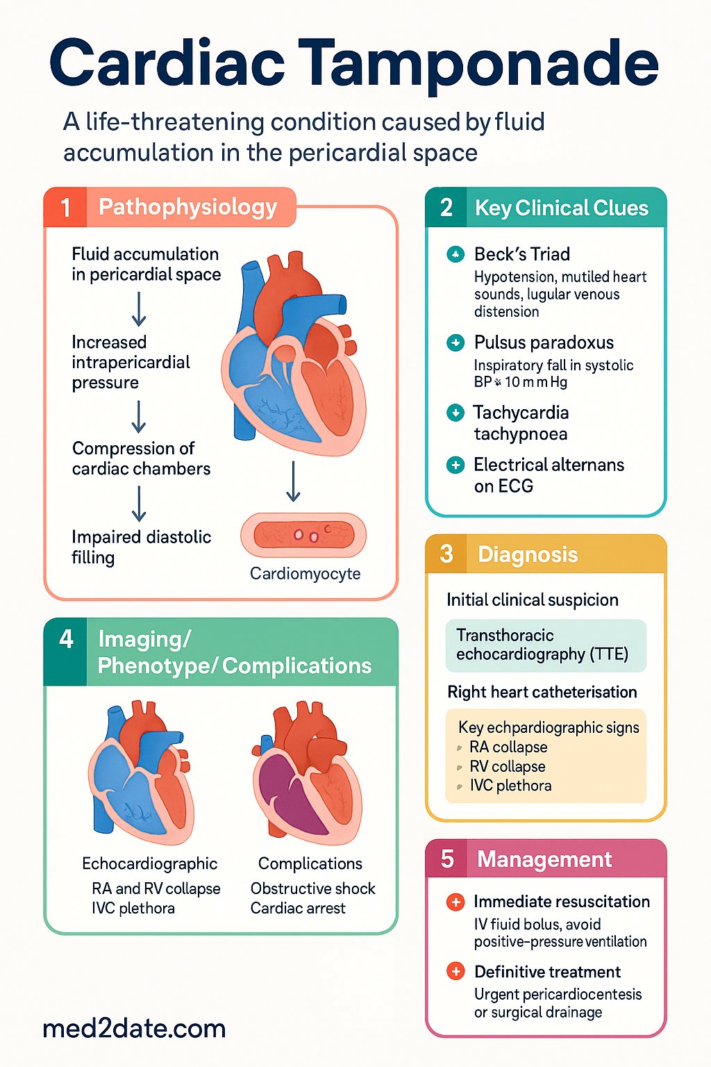 Cardiac Tamponade clinical infographic — pathophysiology, clinical clues, diagnosis, imaging, and management
