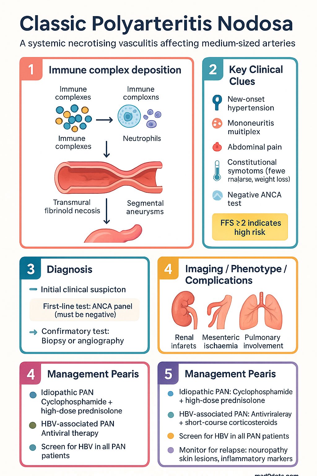 Classic Polyarteritis Nodosa (PAN) clinical infographic — pathophysiology, clinical clues, diagnosis, imaging, and management