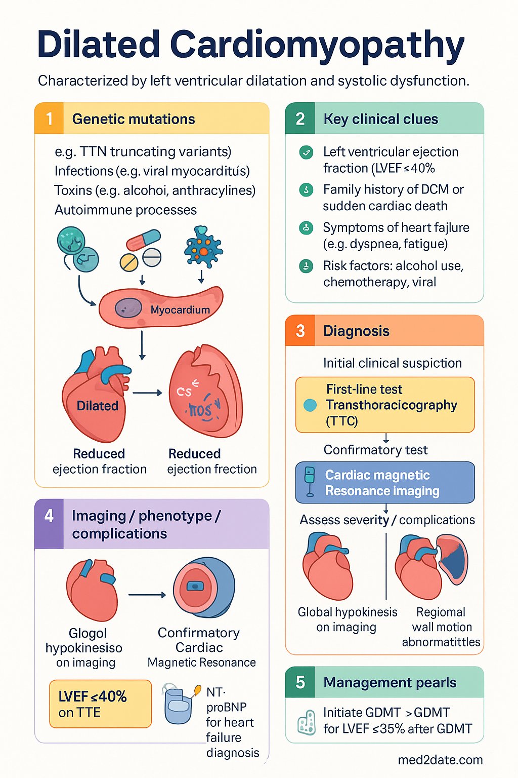Dilated Cardiomyopathy clinical infographic — pathophysiology, clinical clues, diagnosis, imaging, and management