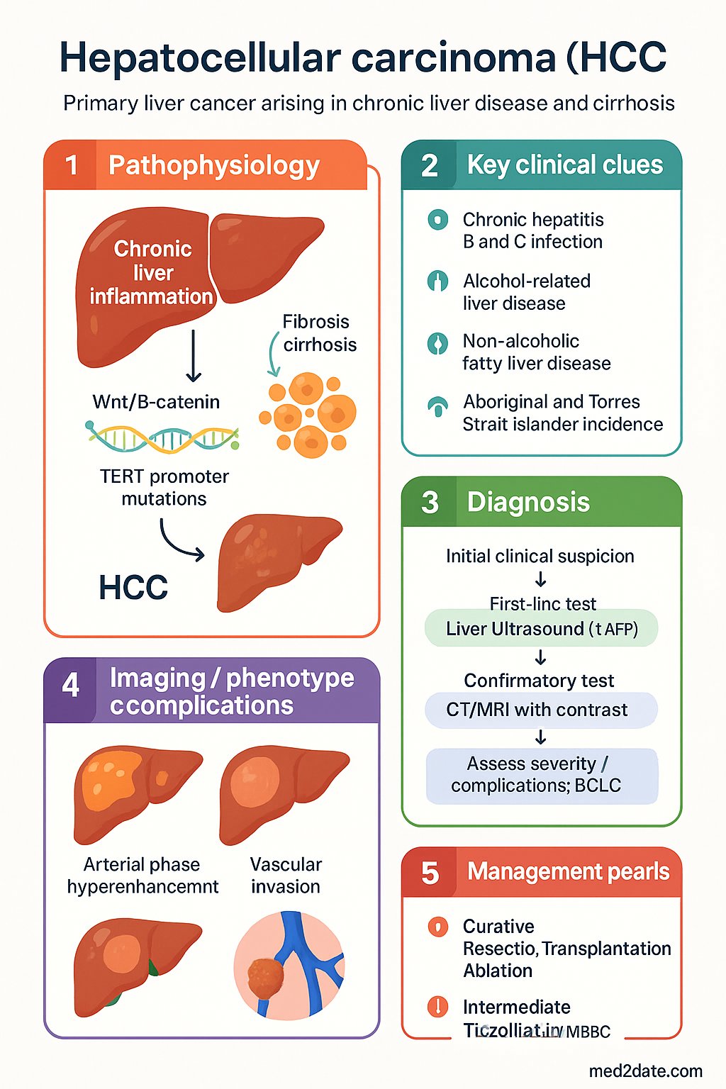 Hepatocellular Carcinoma (HCC) clinical infographic — pathophysiology, clinical clues, diagnosis, imaging, and management