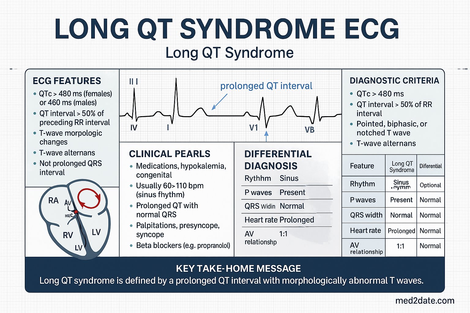 Long QT Syndrome ECG infographic — ECG features, diagnostic criteria, mechanism, clinical pearls, differential diagnosis, and key take-home message