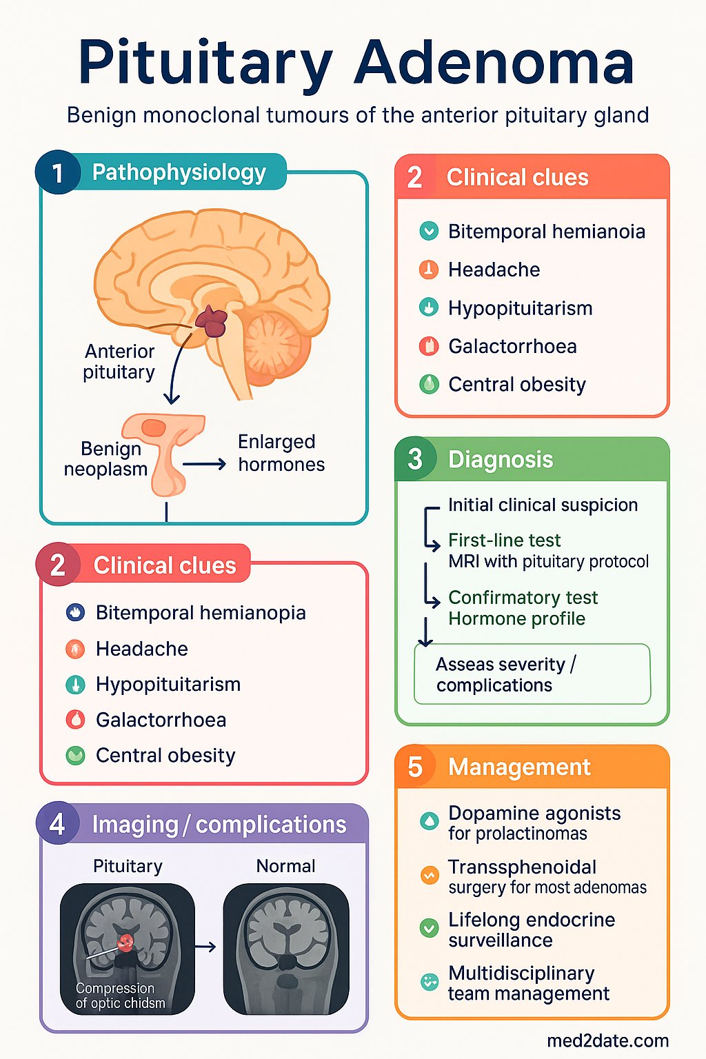 Pituitary Adenoma clinical infographic — pathophysiology, clinical clues, diagnosis, imaging, and management