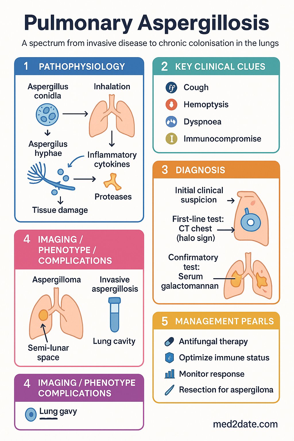 Pulmonary Aspergillosis clinical infographic — pathophysiology, clinical clues, diagnosis, imaging, and management