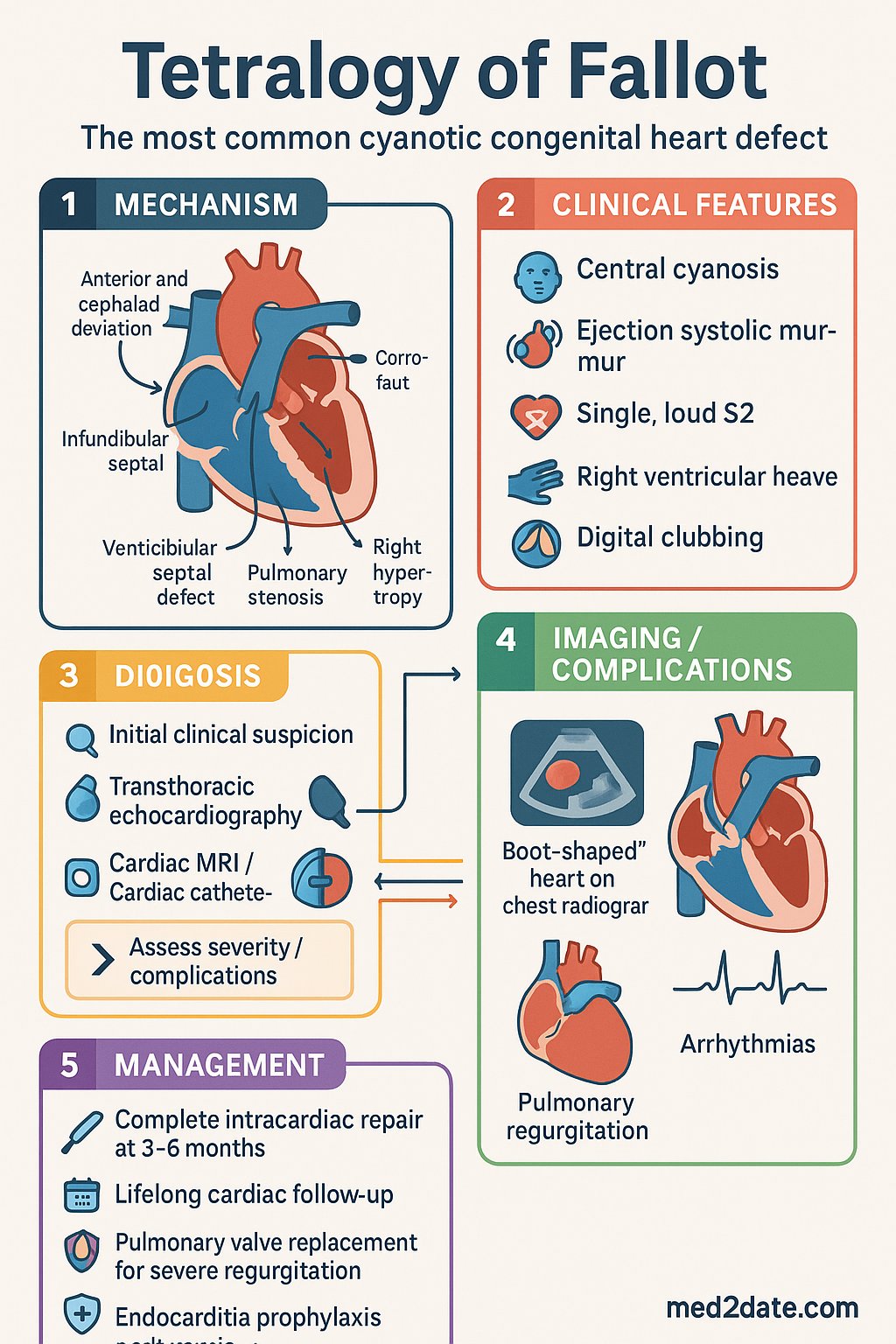 Tetralogy of Fallot clinical infographic — pathophysiology, clinical clues, diagnosis, imaging, and management